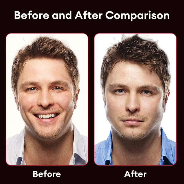 Premium Jawline Exerciser – Silicone Masseter Muscle Trainer for Facial Toner & Chin Lifting – Cheek & Jawline Fitness Equipment for Double Chin, Jawline & Face Shape Improvement - StrengthXPhysiotherapy