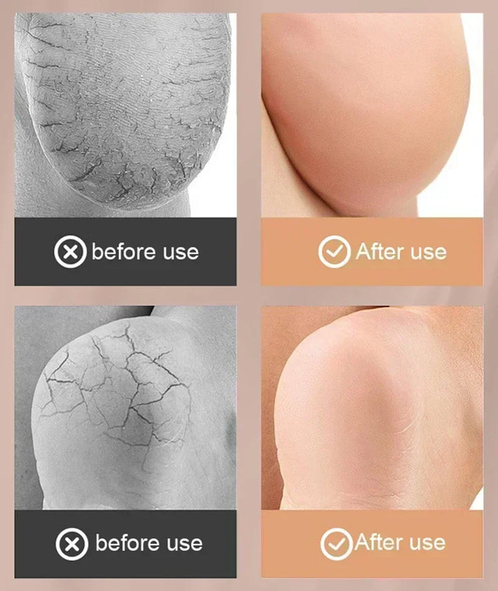 High-Quality Silicone Anti-Cracking Moisturizing Heel Socks - Relieve Heel Pain, Prevent Dry Skin Cracking, & Hydrating Spa 