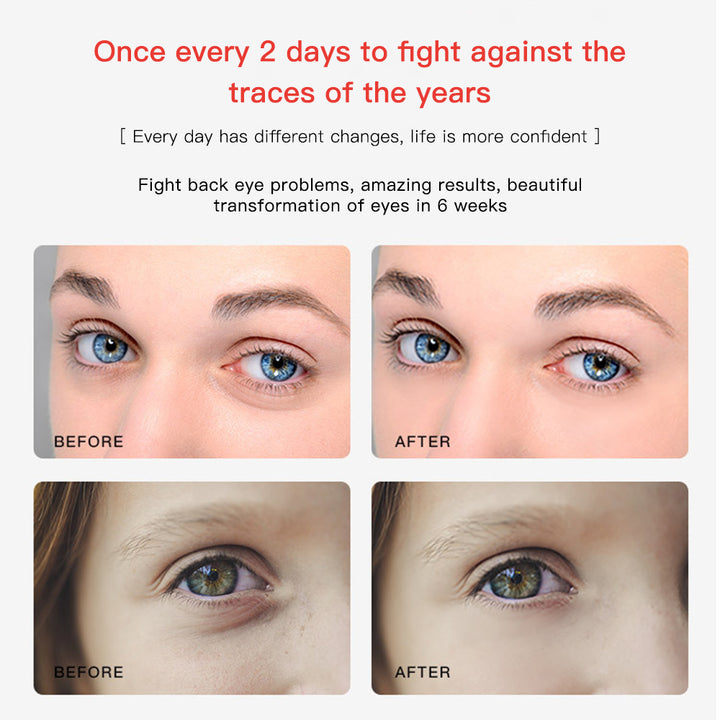 Premium 2 in 1 EMS Eye and Face Vibration Massager – Portable Electric Dark Circle Removal, Anti-Ageing Eye Wrinkle Beauty